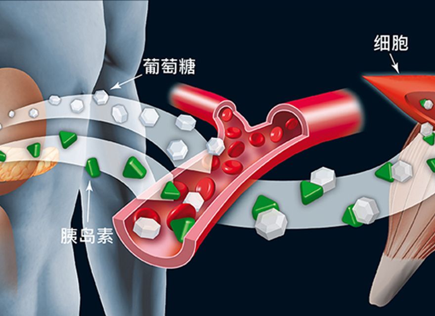 瑞特教你認(rèn)識(shí)糖尿病